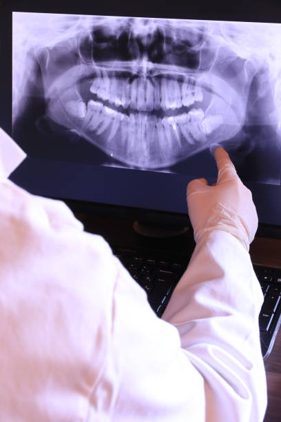 Best Emergency Dental Care for Broken or Chipped Teeth in Forest Heights, TX