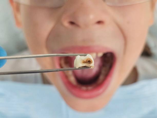 Best Emergency Gum Treatment in Forest Heights, TX