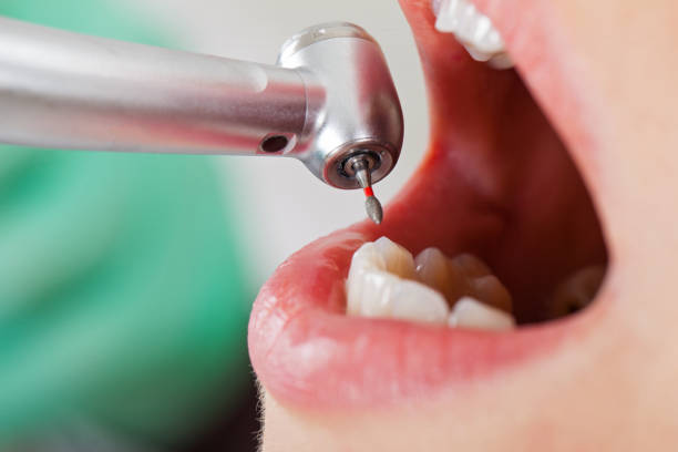 Best Emergency Dental Care for Broken or Chipped Teeth in Forest Heights, TX